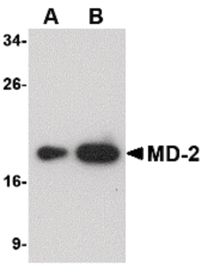 IHC-plus™ LY96 / MD2 / MD-2 Antibody (clone 1A2E3)