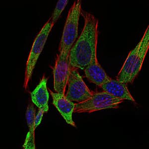PAPLN Antibody (aa766-870, clone 5B2E5)