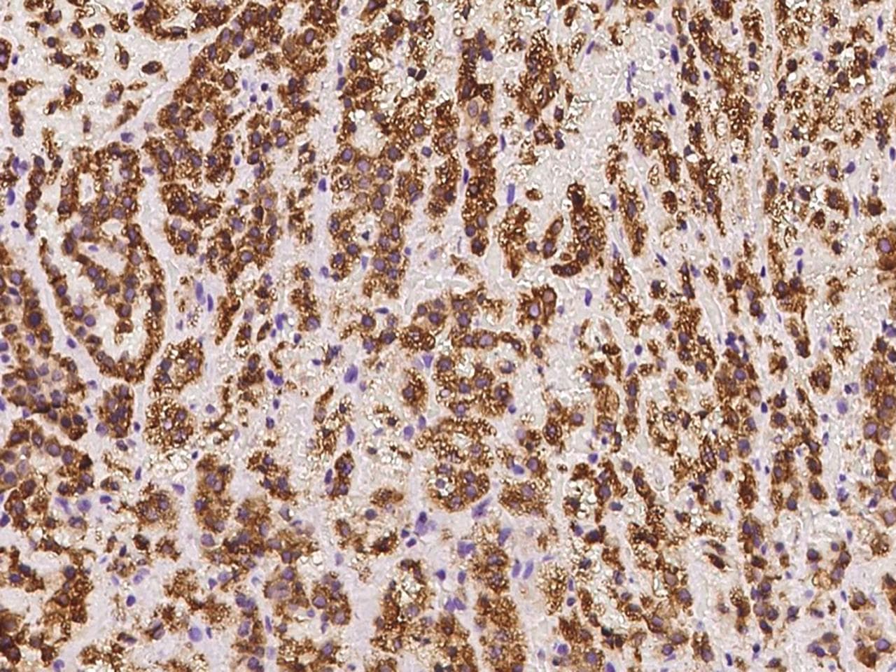 SOAT1 Antibody