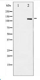 Polyclonal Rabbit anti-Human NOS2 / iNOS Antibody (WB)