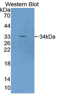 XYLT2 Antibody (aa596-865, PE)