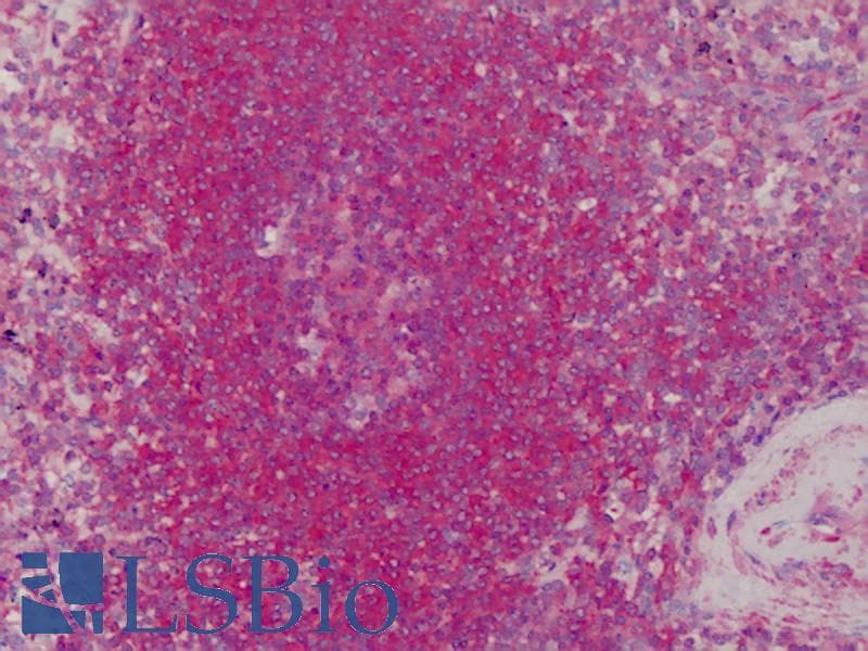 IHC-plus™ Polyclonal Rabbit anti-Human TPM1 / Tropomyosin Antibody (IHC, WB)