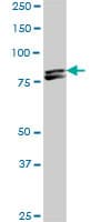 Monoclonal Mouse anti-Human MTA1 Antibody (clone 4D5, WB)