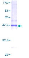 Human AP1S2 Protein (Recombinant GST)