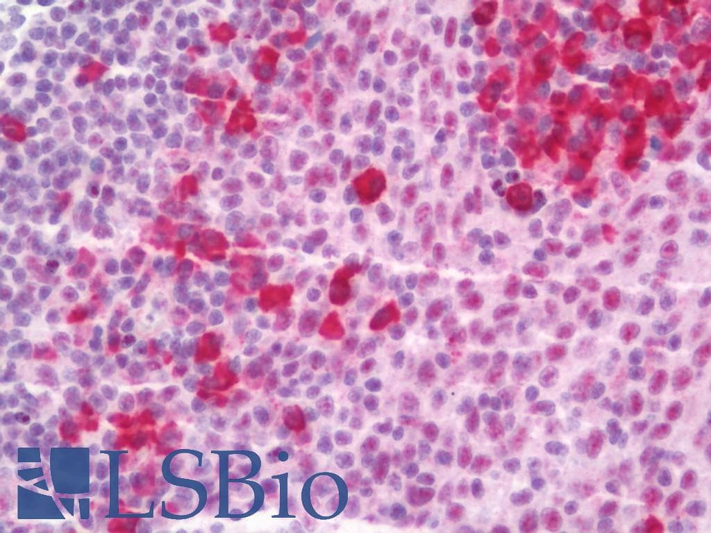 IHC-plus™ NEK2 Antibody (aa396-426)