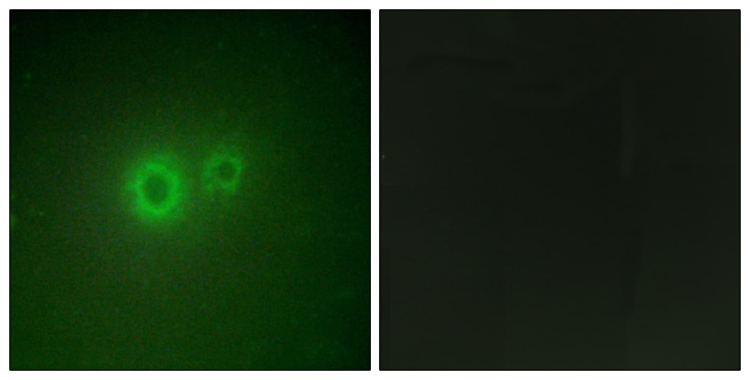 IHC-plus™ Polyclonal Rabbit anti-Human LRAT Antibody (aa111-160, IHC, IF, WB)
