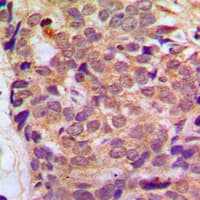 Polyclonal Rabbit anti-Human RGS10 Antibody (Internal, IHC, WB)