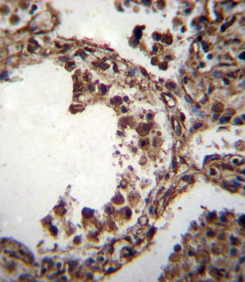 Polyclonal Rabbit anti-Human TUBA1C / Tubulin Alpha 1C Antibody (aa414-441, IHC, WB)