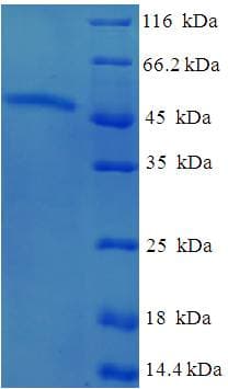 Human AKTIP / FTS Protein (Recombinant His-SUMO)