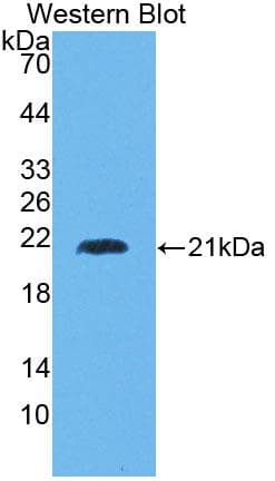 HMMR / CD168 / RHAMM Antibody (aa577-724, FITC)