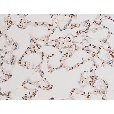 Polyclonal Rabbit anti-Human RELA / NFKB p65 Antibody (phospho-Thr435, IHC, IF, WB)