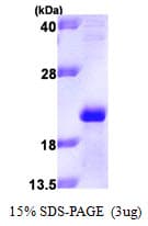 Human APOM / Apolipoprotein M (Recombinant His)