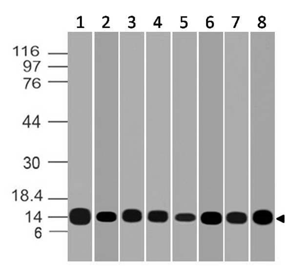 LGALS1 / Galectin 1 Antibody