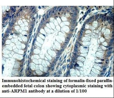 ARPM1 Antibody (aa48-248)