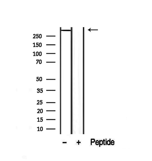 Polyclonal Rabbit anti-Human Dystonin / BPAG1 Antibody (IHC, IF, WB)