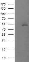 MDM4 / MDMX Antibody (clone OTI3A6)