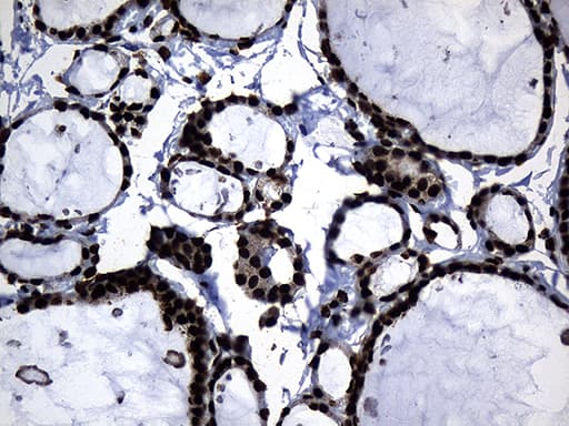 HNRNPH1 / hnRNP H Antibody (clone OTI2D11, Carrier-free)