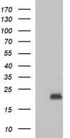 PLA2G16 / HRASLS3 Antibody (clone OTI1H1)