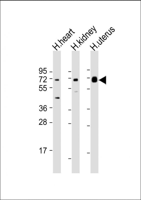 SPTLC3 / C20orf38 Antibody (C-Terminus)