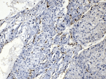 PNP / Nucleoside Phosphorylase Antibody