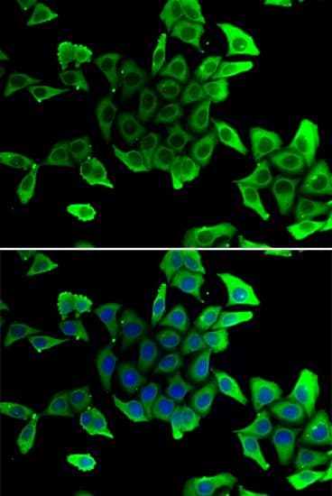 SGCD / Delta-Sarcoglycan Antibody