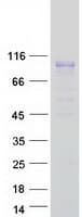Human FLRT2 Protein (Recombinant Myc-DDK (Flag))
