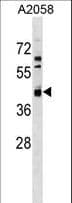 Polyclonal Rabbit anti-Human AMDHD2 Antibody (aa137-164, WB)