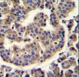 Polyclonal Rabbit anti-Human TRIM72 / MG53 Antibody (aa299-327, IHC, WB)
