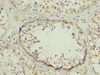 Polyclonal Rabbit anti-Human SPZ1 Antibody (IHC, WB)