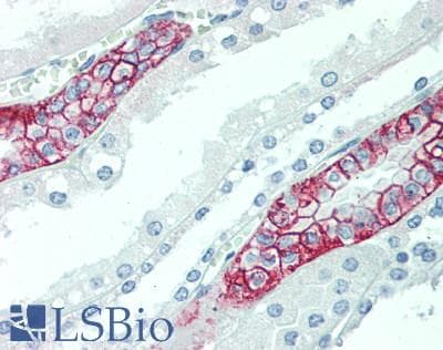 IHC-plus™ Polyclonal Rabbit anti-Human SCN10A / Nav1.8 Antibody (aa31-45, IHC)