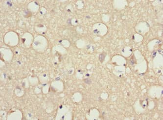 IFRD1 / TIS7 Antibody