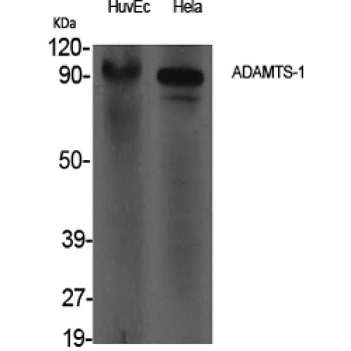 Polyclonal Rabbit anti-Human ADAMTS1 Antibody (160-240 aa, Internal, WB)