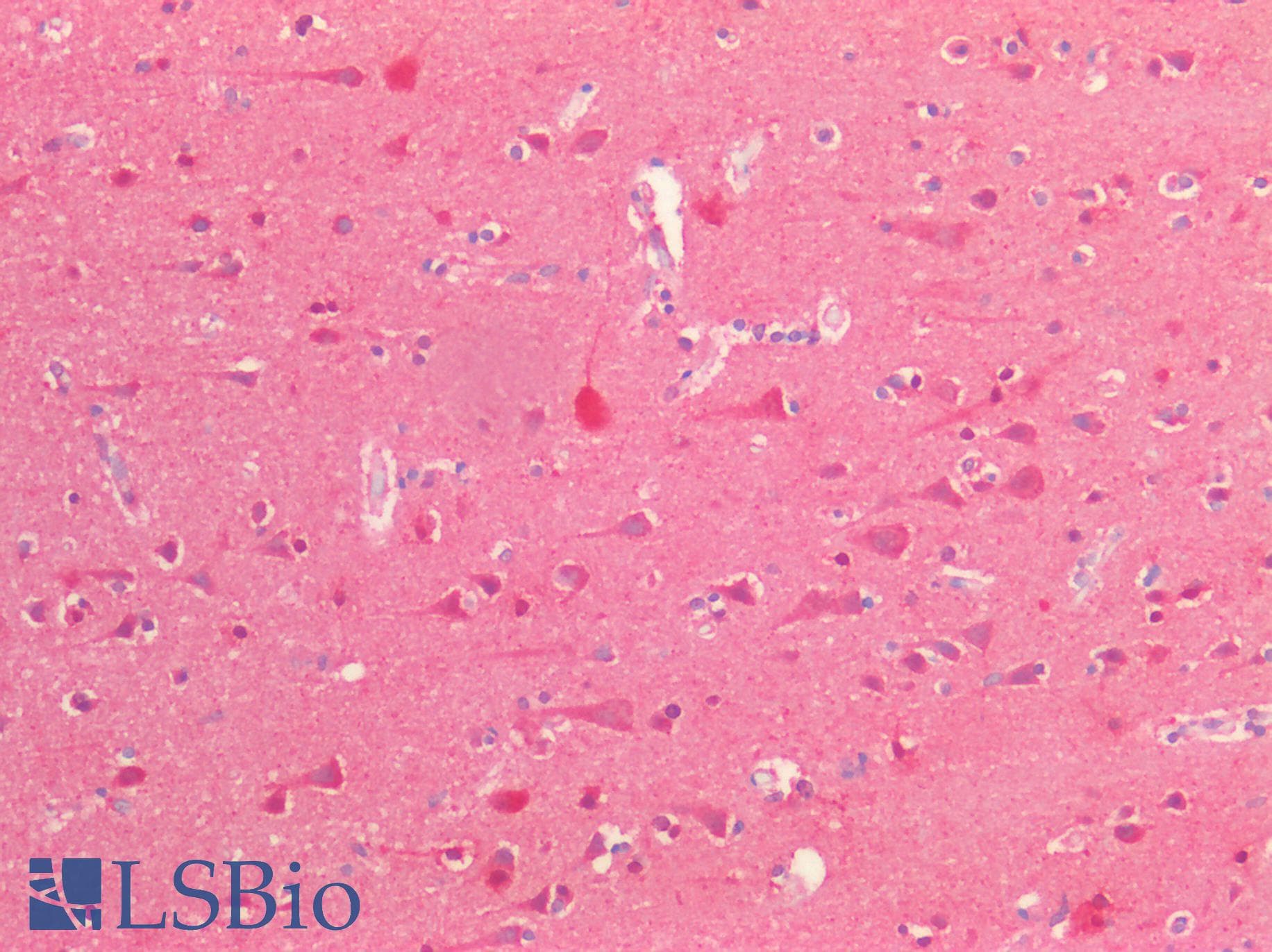 IHC-plus™ Polyclonal Rabbit anti-Human GABARAPL2 / ATG8 Antibody (IHC, IF, WB)