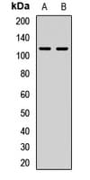 Polyclonal Rabbit anti-Human SEMA4C / Semaphorin 4C Antibody (WB)