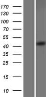 SEC62 / TP-1 Protein (Over-Expression Lysate Myc-DDK (Flag))