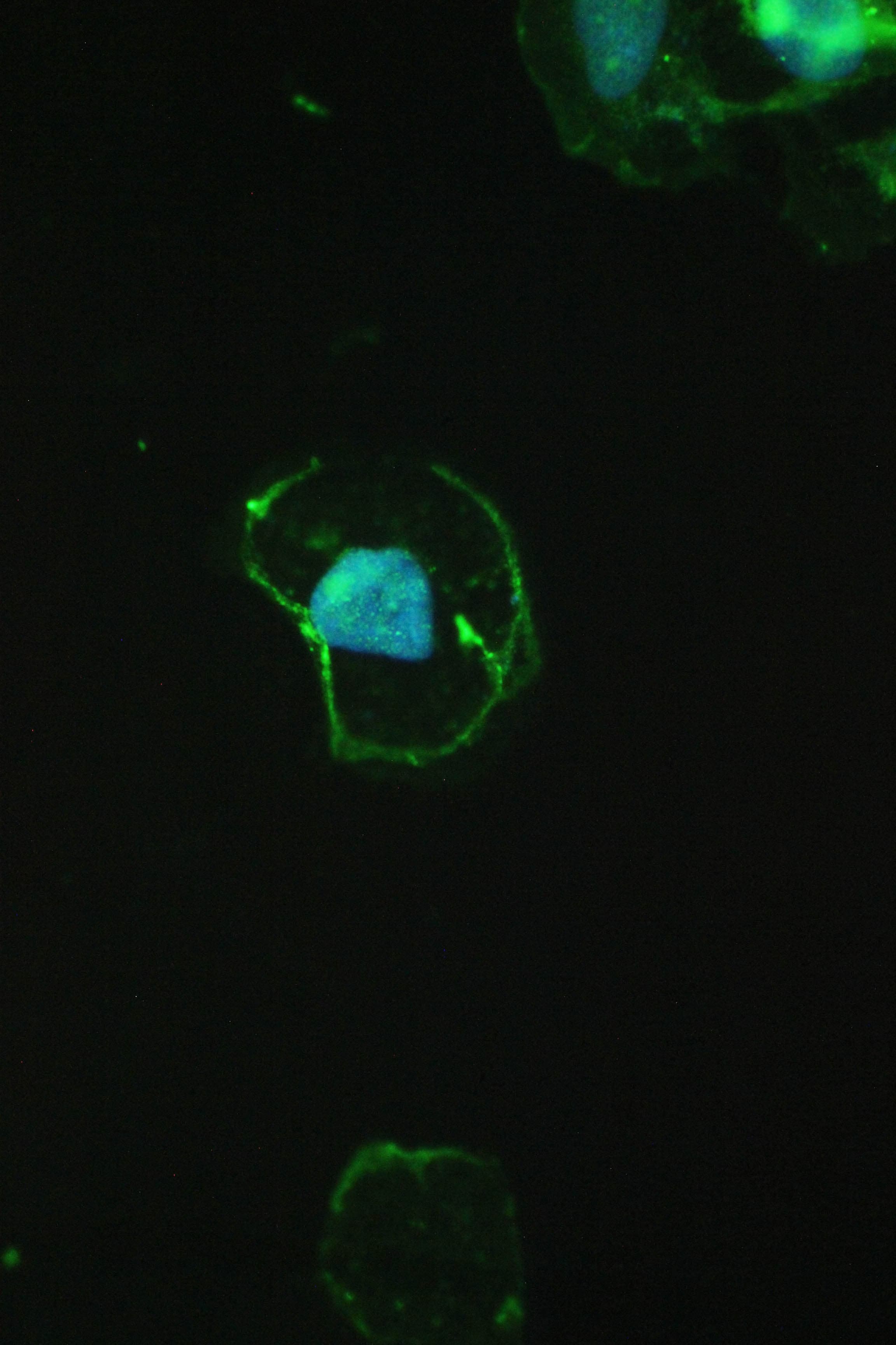 CTNNB1 / Beta Catenin Antibody