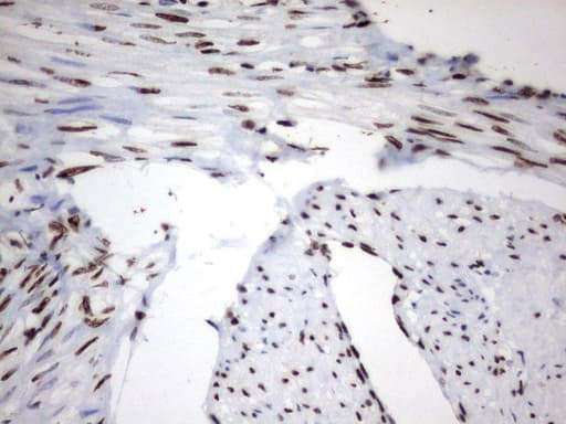 MLF1 Antibody (clone UMAB138, Carrier-free)