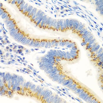 TERE1 / UBIAD1 Antibody