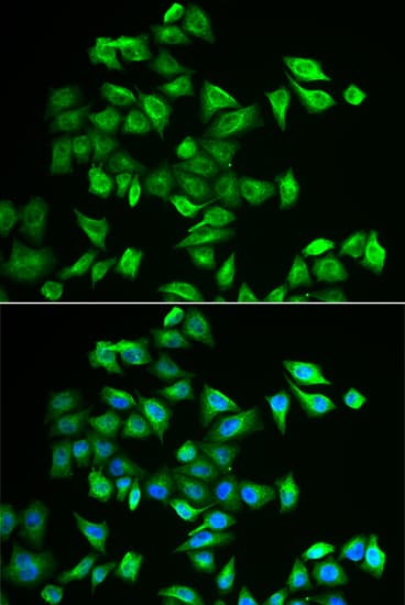 Polyclonal Rabbit anti-Human POMGNT2 / GTDC2 Antibody (IHC, IF, WB)