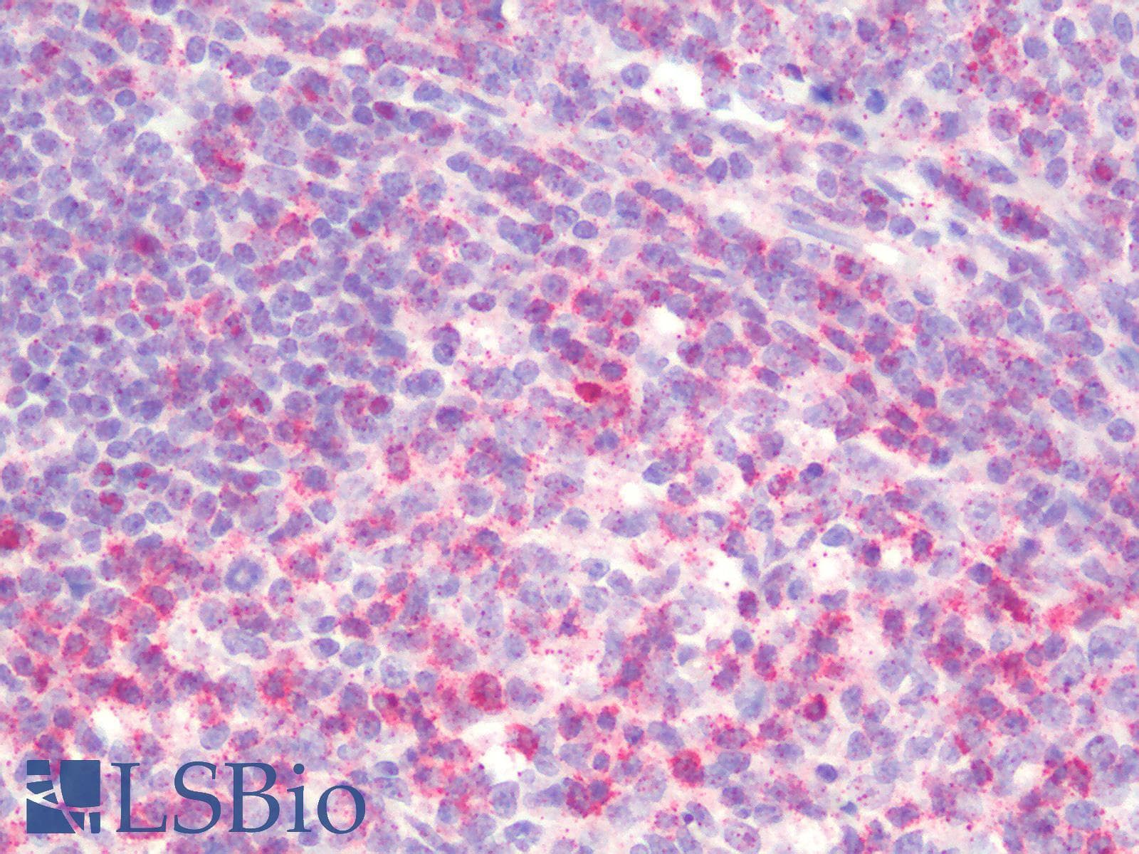 PathPlus™ CD2 Antibody