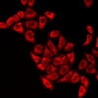 TS / Thromboxane Synthase Antibody