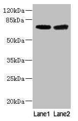 Polyclonal Rabbit anti-Human GALNT15 / GALNTL2 Antibody (IHC, WB)