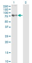 SKIL / SNO / SnoN Antibody (clone 1C12)