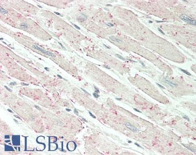 IHC-plus™ PRKCA / PKC-Alpha Antibody (aa1-30)