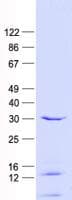 Human RGS3 Protein (Recombinant His, N-Terminal)