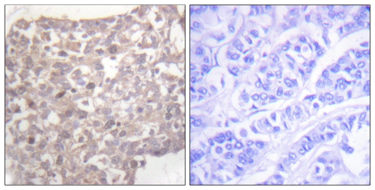 Tubulin Gamma Antibody