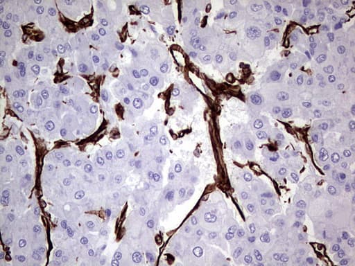 Vimentin Antibody (clone UMAB160, Carrier-free)