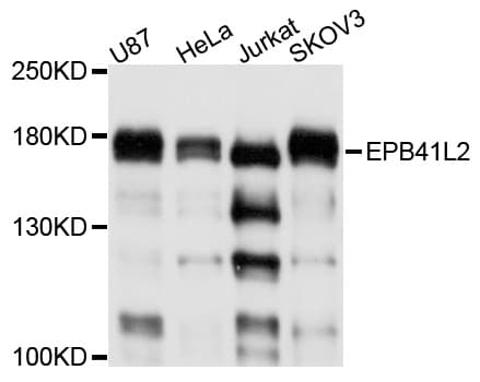 Polyclonal Rabbit anti-Human EPB41L2 Antibody (IF, WB)
