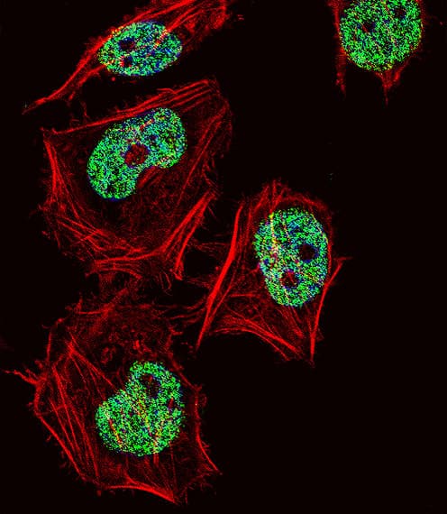 CUX1 / CASP Antibody (aa1347-1374)