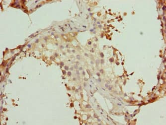 Polyclonal Rabbit anti-Human WDR47 Antibody (IHC)